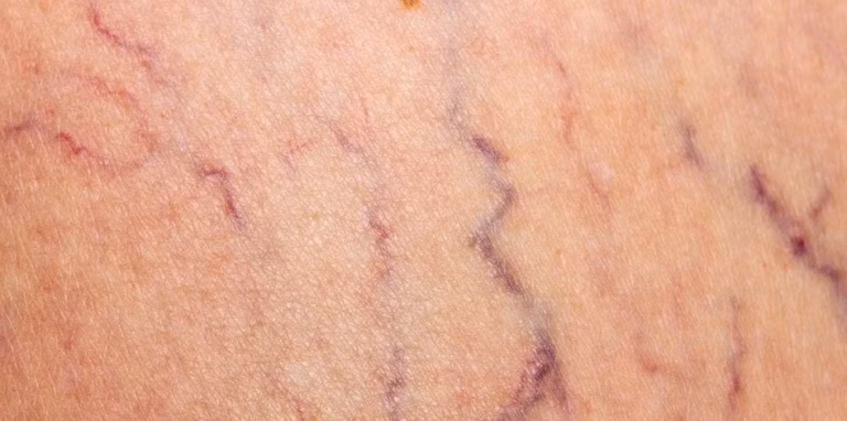 Combien de Temps Dure un Tatouage Temporaire : Durée Moyenne
